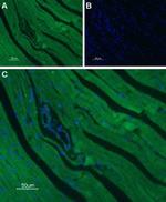 CaV1.2 (CACNA1C) Antibody in Immunohistochemistry (Paraffin) (IHC (P))