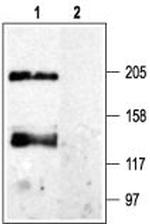 CaVpan alpha 1 Antibody in Western Blot (WB)