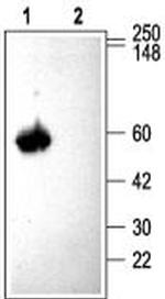 CACNB3 Antibody in Western Blot (WB)