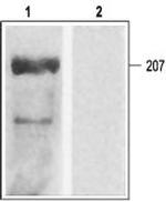 CaV1.2a (CACNA1C) Antibody in Western Blot (WB)