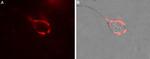 CACNA2D1 (CaV alpha 2 delta 1) (extracellular) Antibody in Immunocytochemistry (ICC/IF)