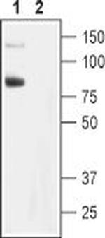 TRPC6 Antibody in Western Blot (WB)