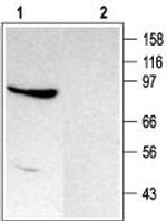 TRPC4 Antibody in Western Blot (WB)