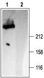 IP3 Receptor-1 (ITPR1) Antibody in Western Blot (WB)