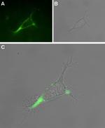 TRPV1 (VR1) (extracellular) Antibody in Immunocytochemistry (ICC/IF)