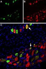 TRPV1 (VR1) (extracellular) Antibody in Immunohistochemistry (Frozen) (IHC (F))