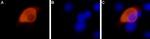 TRPV1 (VR1) Antibody in Immunocytochemistry (ICC/IF)