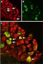 TRPV1 (VR1) Antibody in Immunohistochemistry (IHC)