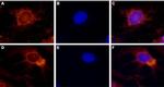 TRPV4 Antibody in Immunocytochemistry (ICC/IF)