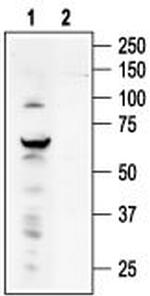 TRPV4 Antibody in Western Blot (WB)