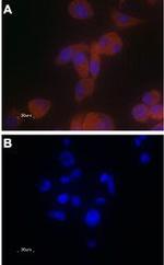 TRPV6 Antibody in Immunocytochemistry (ICC/IF)