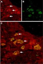 TRPV6 Antibody in Immunohistochemistry (IHC)