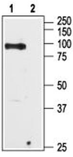 TRPV6 Antibody in Western Blot (WB)