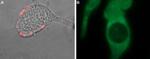 TRPM8 (extracellular) Antibody in Immunocytochemistry (ICC/IF)