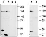 TRPM8 (extracellular) Antibody in Western Blot (WB)