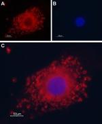 TRPP1 (PKD2) Antibody in Immunocytochemistry (ICC/IF)