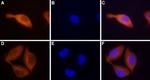 STIM2 Antibody in Immunocytochemistry (ICC/IF)