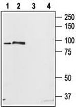 STIM2 Antibody in Western Blot (WB)