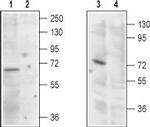 TRPML1 (Mucolipin 1) Antibody in Western Blot (WB)