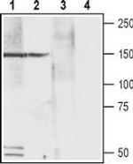 CACNA2D4 (CaV alpha 2 delta 4) (extracellular) Antibody in Western Blot (WB)