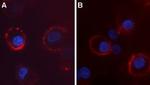 CACNA2D4 (CaV alpha 2 delta 4) (extracellular) Antibody in Immunocytochemistry (ICC/IF)