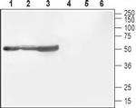 CACNB1 Antibody in Western Blot (WB)