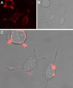 TRPC4 (extracellular) Antibody in Immunocytochemistry (ICC/IF)