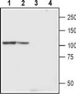 TRPC4 (extracellular) Antibody in Western Blot (WB)