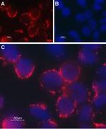 TRPC6 (extracellular) Antibody in Immunocytochemistry (ICC/IF)