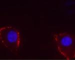 TRPV4 (extracellular) Antibody in Immunocytochemistry (ICC/IF)