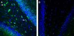 TRPM7 (extracellular) Antibody in Immunohistochemistry (Frozen) (IHC (F))