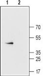 Connexin-43 Antibody in Western Blot (WB)