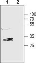 Connexin-32 Antibody in Western Blot (WB)