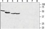 MCU Antibody in Western Blot (WB)