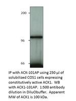 ACK1 Antibody in Western Blot (WB)