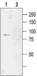 CLC-2 (CLCN2) Antibody in Western Blot (WB)