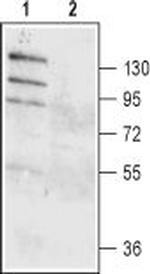 TMEM16A (ANO1) (extracellular) Antibody in Western Blot (WB)