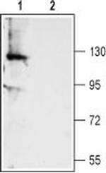 TMEM16A (ANO1) (extracellular) Antibody in Western Blot (WB)