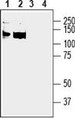 Anoctamin-6 (extracellular) Antibody in Western Blot (WB)