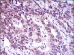 ATP Citrate Lyase Antibody in Immunohistochemistry (Paraffin) (IHC (P))