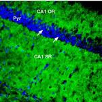 PMCA1 Antibody in Immunohistochemistry (Frozen) (IHC (F))