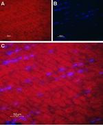 SERCA1 Antibody in Immunohistochemistry (Paraffin) (IHC (P))