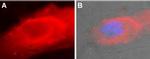 SERCA2 Antibody in Immunocytochemistry (ICC/IF)