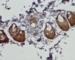 Cannabinoid Receptor 2 Antibody in Immunohistochemistry (Paraffin) (IHC (P))