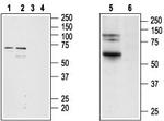 Cannabinoid Receptor 2 Antibody in Western Blot (WB)