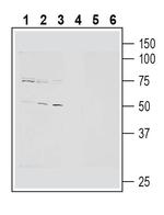 Cannabinoid Receptor 2 Antibody in Western Blot (WB)