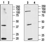 Cannabinoid Receptor 2 (extracellular) Antibody in Western Blot (WB)