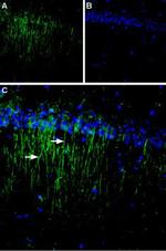 Calcium Sensing Receptor (extracellular) Antibody in Immunohistochemistry (IHC)