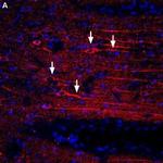 CXCR4 (extracellular) Antibody in Immunohistochemistry (Frozen) (IHC (F))