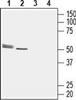 CMKLR1 (extracellular) Antibody in Western Blot (WB)